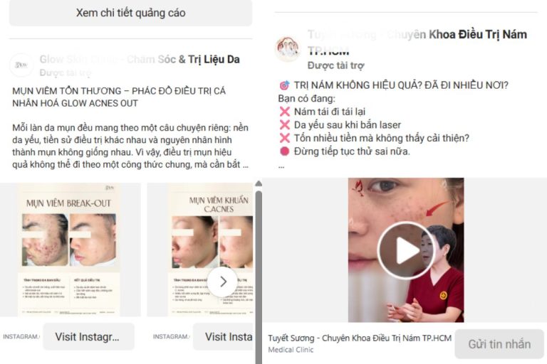 Hướng dẫn cách quảng cáo spa ra khách mỗi ngày