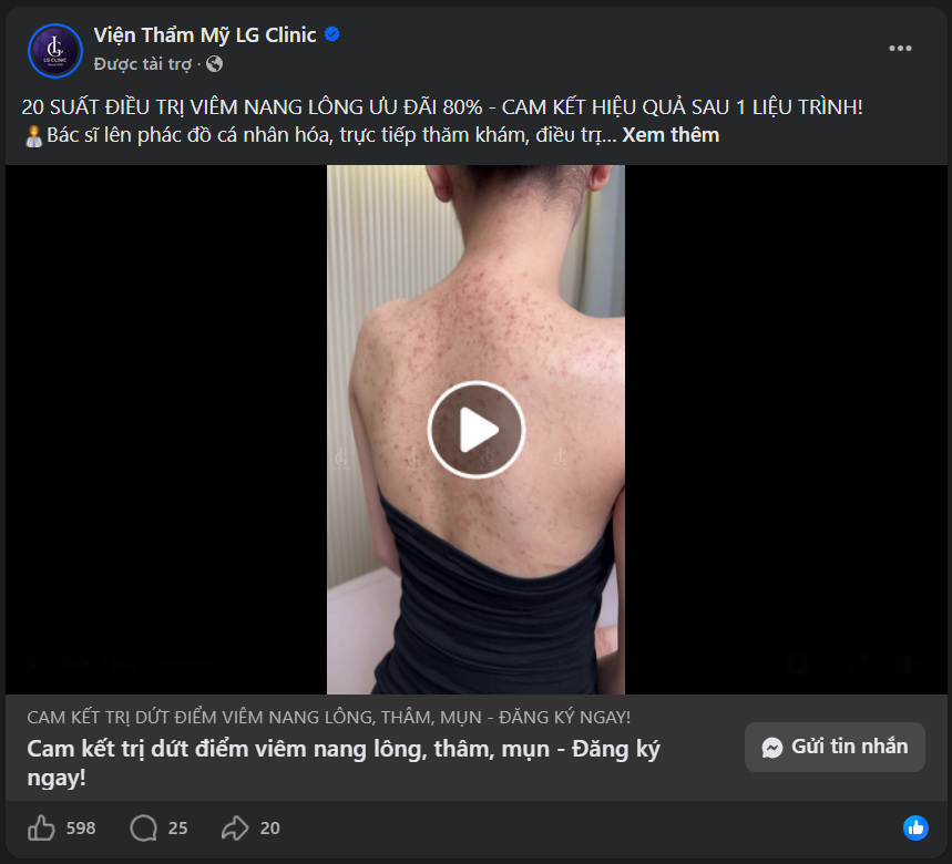 Mục tiêu tin nhắn rất phù hợp với quảng cáo spa để tiện tư vấn khách hàng