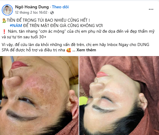 Vì sao quảng cáo Facebook là kênh chính của spa?